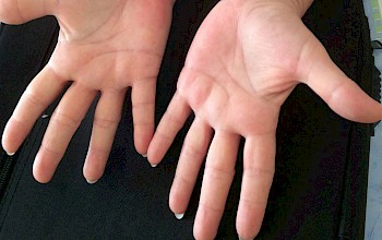 Palmistry – What do your  hands reveal